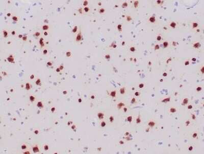 Immunohistochemistry-Paraffin: RBFOX3/NeuN Antibody (NeuN/6694R) [NBP3-13858]