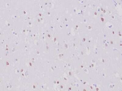 Immunohistochemistry-Paraffin: RBFOX3/NeuN Antibody (NeuN/6694R) [NBP3-13858]