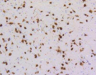 Immunohistochemistry-Paraffin: RBFOX3/NeuN Antibody (SR45-07) [NBP2-67314]