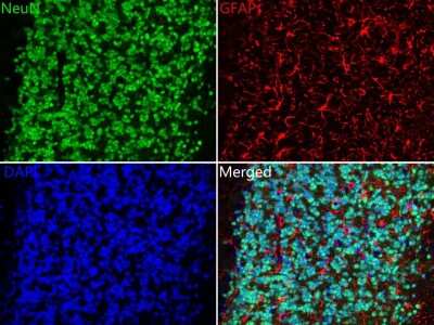 Immunohistochemistry-Paraffin: RBFOX3/NeuN Antibody (SR45-07) [NBP2-67314]
