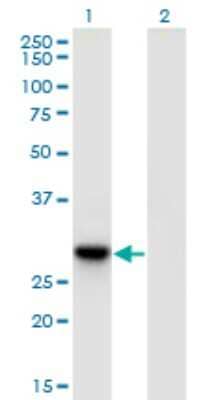 Western Blot: RBJ Antibody (3C1) [H00051277-M09]