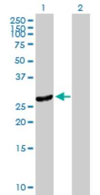 Western Blot: RBJ Antibody [H00051277-B01P]