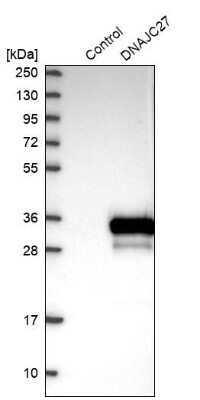 Western Blot: RBJ Antibody [NBP1-80857]