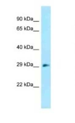 Western Blot: RBJ Antibody [NBP1-98571]