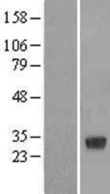 Western Blot: RBJ Overexpression Lysate [NBL1-15190]