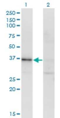 Western Blot: RBKS Antibody (3B4) [H00064080-M01]