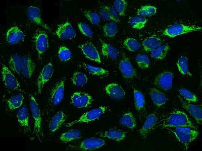 Immunocytochemistry/ Immunofluorescence: RBKS Antibody [NBP2-97078]