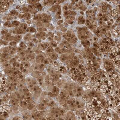 Immunohistochemistry-Paraffin: RBKS Antibody [NBP1-84115]