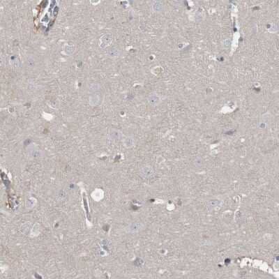 Immunohistochemistry-Paraffin: RBKS Antibody [NBP1-84115]