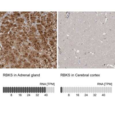 Immunohistochemistry-Paraffin: RBKS Antibody [NBP1-84115]