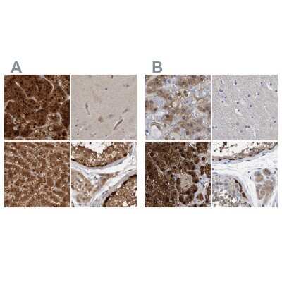 Immunohistochemistry-Paraffin: RBKS Antibody [NBP1-84115]