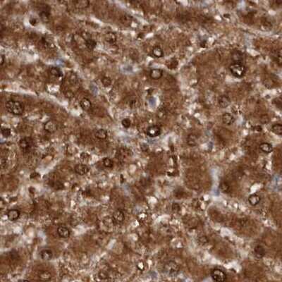 Immunohistochemistry-Paraffin: RBKS Antibody [NBP1-84115]