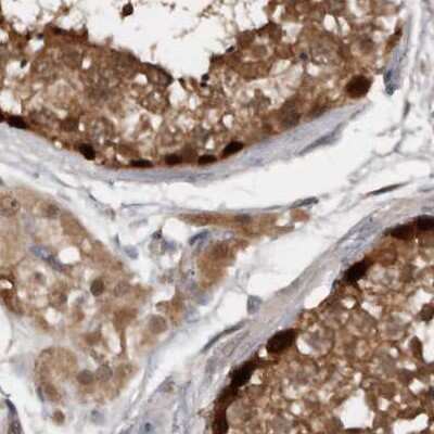 Immunohistochemistry-Paraffin: RBKS Antibody [NBP1-84115]