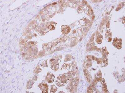Immunohistochemistry-Paraffin: RBKS Antibody [NBP2-20099]