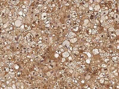 Immunohistochemistry-Paraffin: RBKS Antibody [NBP2-97079]