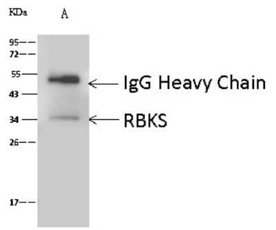 Immunoprecipitation: RBKS Antibody [NBP2-97079]
