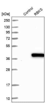 Western Blot: RBKS Antibody [NBP1-84116]