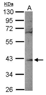 Western Blot: RBKS Antibody [NBP2-20099]