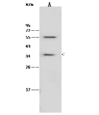 Western Blot: RBKS Antibody [NBP2-97079]