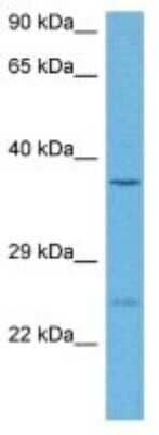 Western Blot: RBKS Antibody [NBP3-10179]