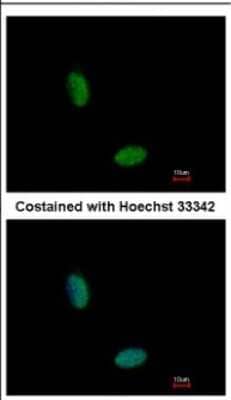 Immunocytochemistry/ Immunofluorescence: RBM10 Antibody [NBP2-20100]