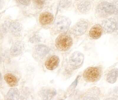 Immunohistochemistry-Paraffin: RBM10 Antibody [NB100-55265]