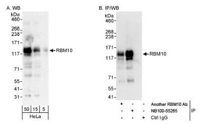 Western Blot: RBM10 Antibody [NB100-55265]