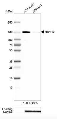 Western Blot: RBM10 Antibody [NBP1-84951]