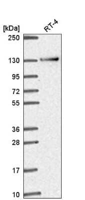 Western Blot: RBM10 Antibody [NBP2-56831]