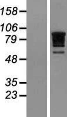 Western Blot: RBM10 Overexpression Lysate [NBL1-15194]