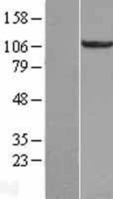 Western Blot: RBM10 Overexpression Lysate [NBL1-15195]