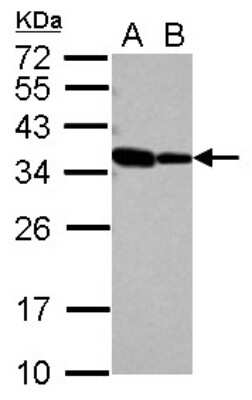 Western Blot: RBM11 Antibody [NBP2-20101]