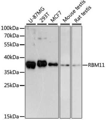 Western Blot: RBM11 AntibodyAzide and BSA Free [NBP2-93777]