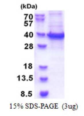 SDS-PAGE: Recombinant Human RBM11 His Protein [NBP2-23444]