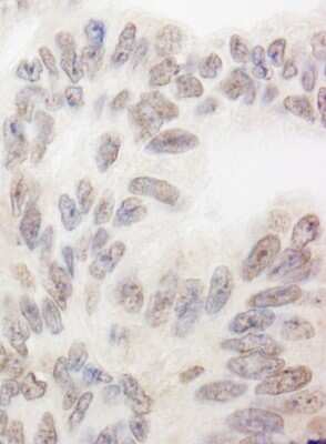 Immunohistochemistry: RBM12 Antibody [NB100-59846]