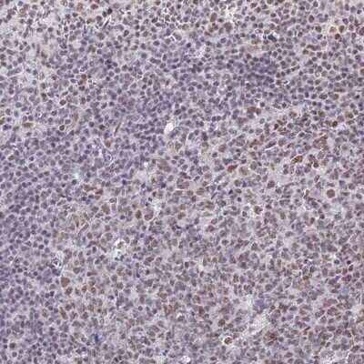 Immunohistochemistry-Paraffin: RBM12 Antibody [NBP2-13208]