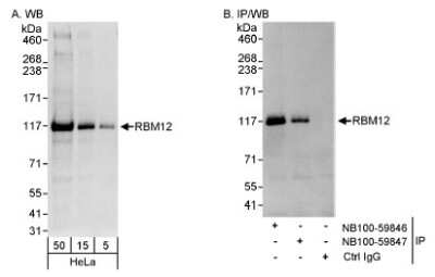 Western Blot: RBM12 Antibody [NB100-59846]