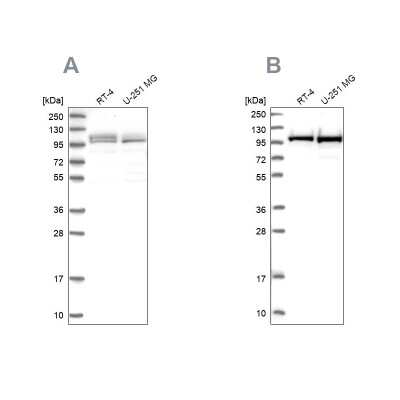 Western Blot: RBM12 Antibody [NBP2-13207]