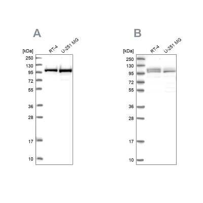 Western Blot: RBM12 Antibody [NBP2-13208]