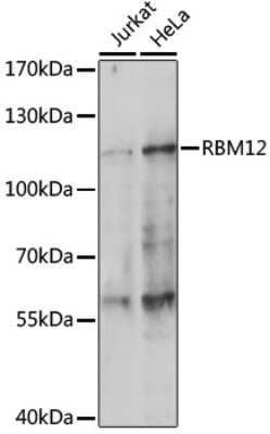 Western Blot: RBM12 AntibodyAzide and BSA Free [NBP2-93784]