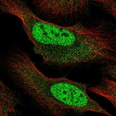 Immunocytochemistry/ Immunofluorescence: RBM12B Antibody [NBP2-55667]