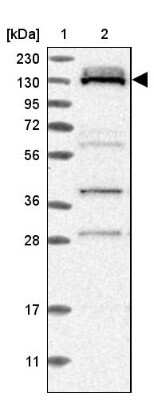 Western Blot: RBM12B Antibody [NBP1-85981]