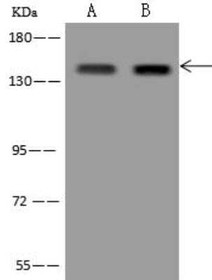 Western Blot: RBM12B Antibody [NBP3-12629]