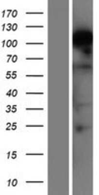 Western Blot: RBM12B Overexpression Lysate [NBP2-04563]