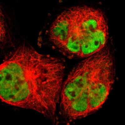 Immunocytochemistry/ Immunofluorescence: RBM14 Antibody [NBP1-84416]