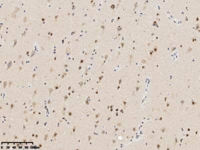 Immunohistochemistry: RBM14 Antibody [NBP3-14796]