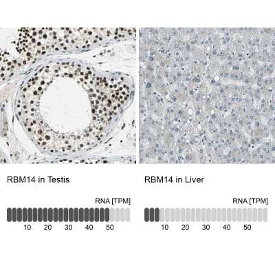 Immunohistochemistry-Paraffin: RBM14 Antibody [NBP1-84416]