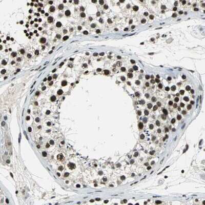 Immunohistochemistry-Paraffin: RBM14 Antibody [NBP1-84416]
