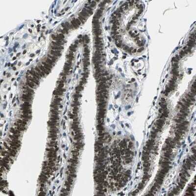 Immunohistochemistry-Paraffin: RBM14 Antibody [NBP1-84416]