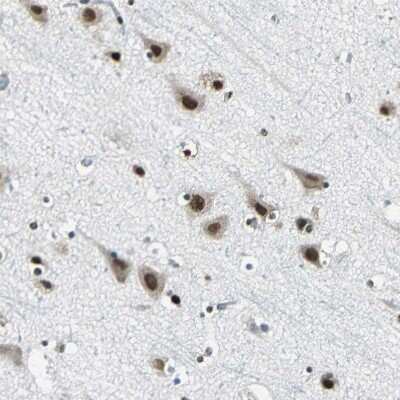 Immunohistochemistry-Paraffin: RBM14 Antibody [NBP1-84416]